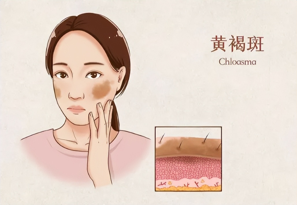 刮痧的九种禁忌症你知道哪些,简述刮痧的禁忌范围和慎刮事项