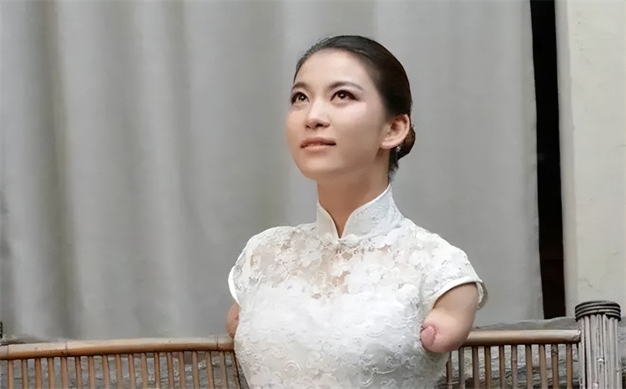 截肢女孩雷庆瑶近况,雷庆瑶触电事件