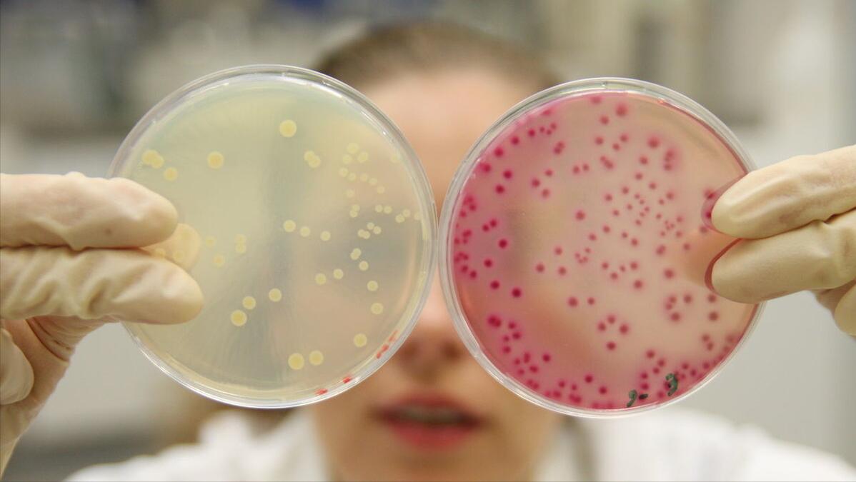 非滴虫非霉菌性阴道炎的症状表现,霉菌性阴道炎症状怎么治疗最有效