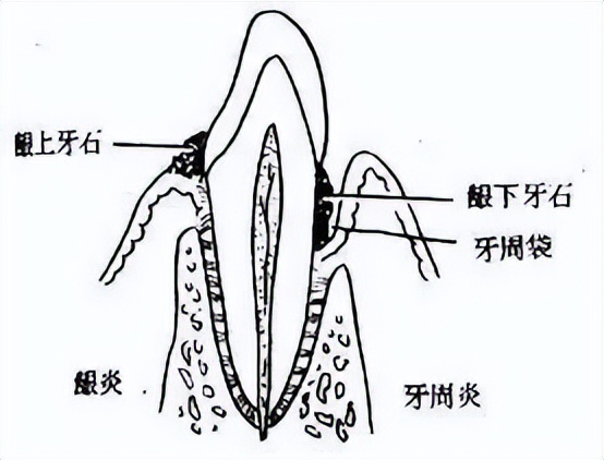牙龈出血牙齿松动最佳补救方法,牙龈出血牙齿松动怎么办