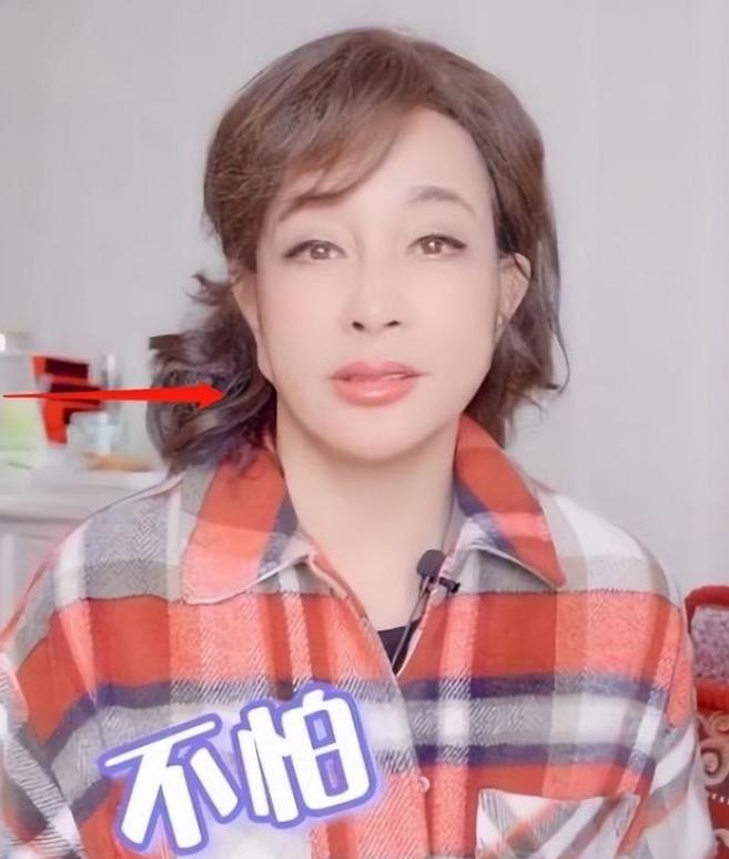 明星下颚骨整容后遗症,脸像鞋拔子怎么改善