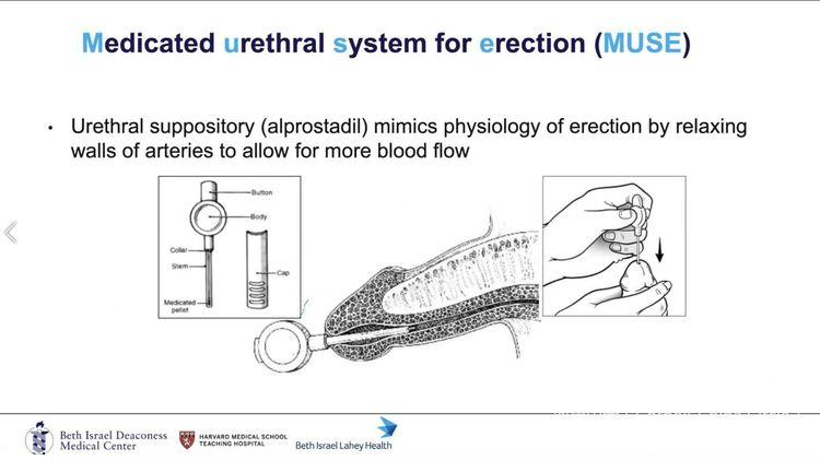 勃起功能障碍---别忽略了是糖尿病惹的祸怎么办..