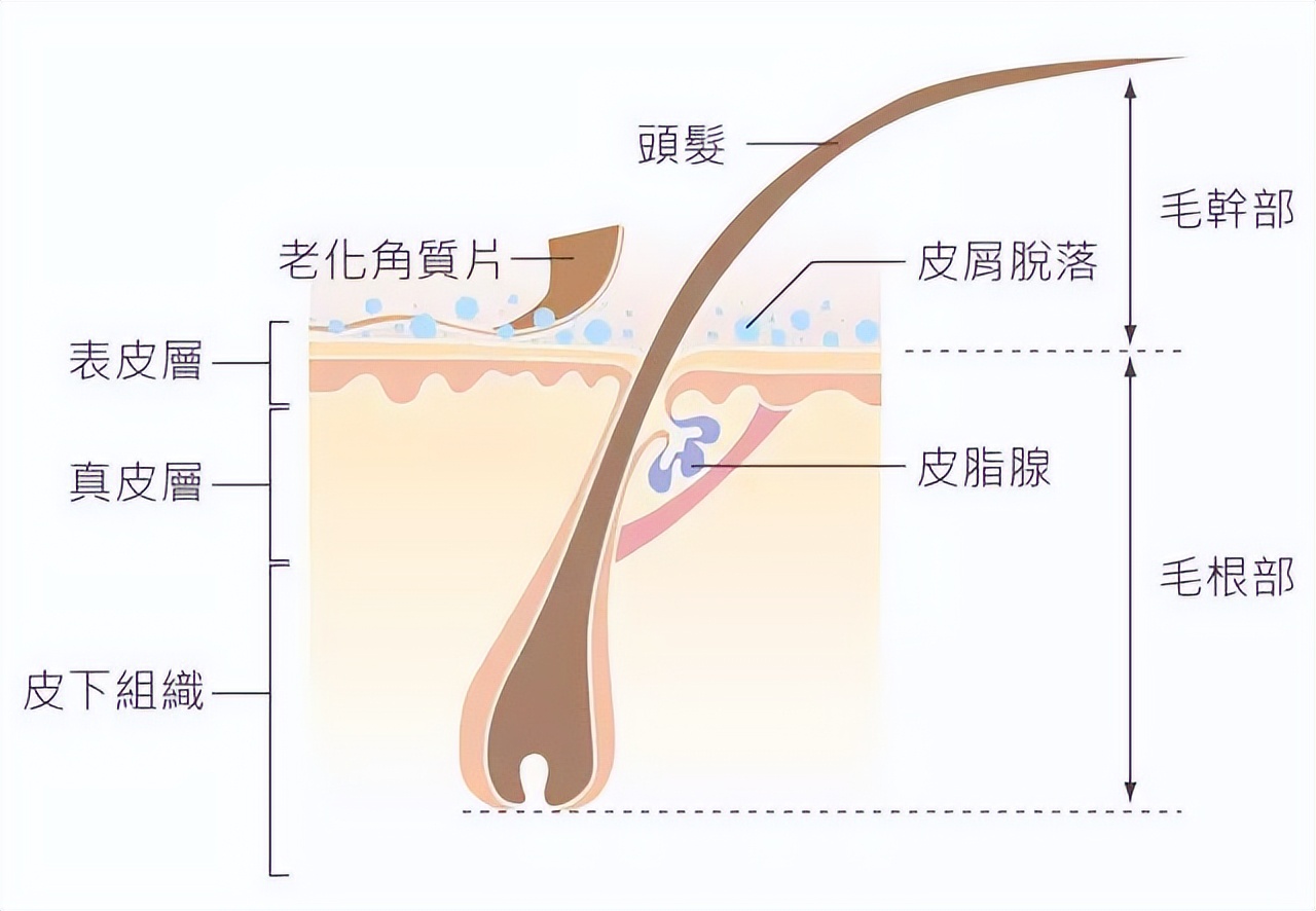 头皮屑太多了怎么处理我教你一招,头皮痒头皮屑多有救了