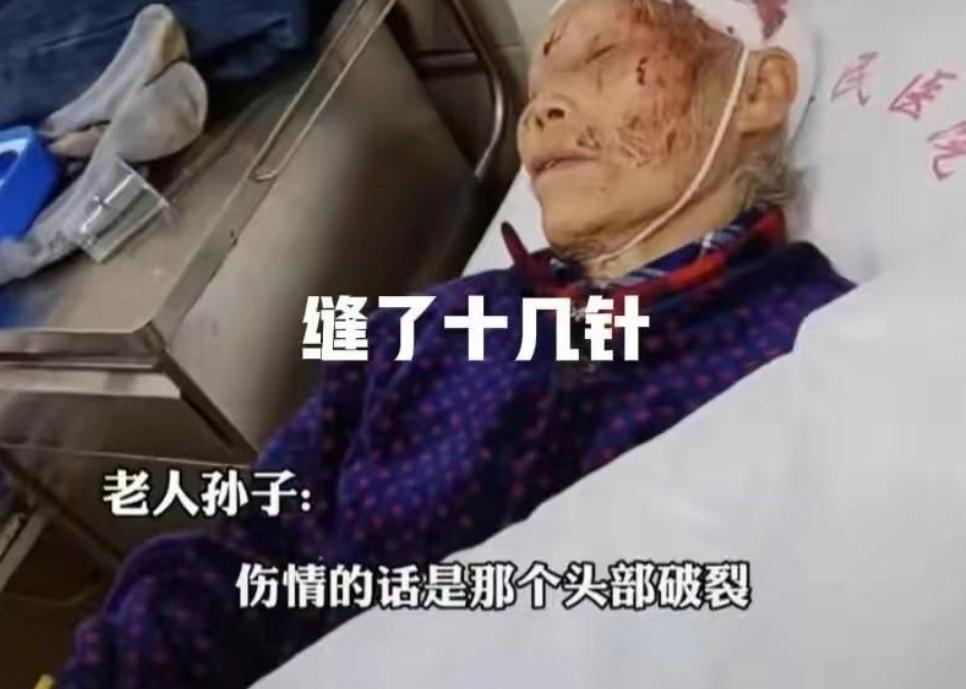 除夕夜儿媳殴打83岁婆婆，倒地后被丈夫一脚踢开，目前未脱离危险