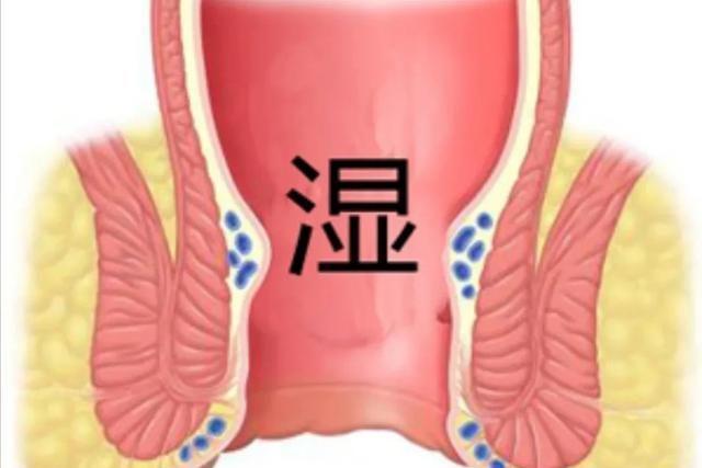 难以启齿的疾病,难以启齿的病症有哪些