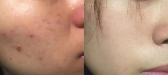 十大公认好用的水乳品牌孕妇,温和无刺激的安全水乳