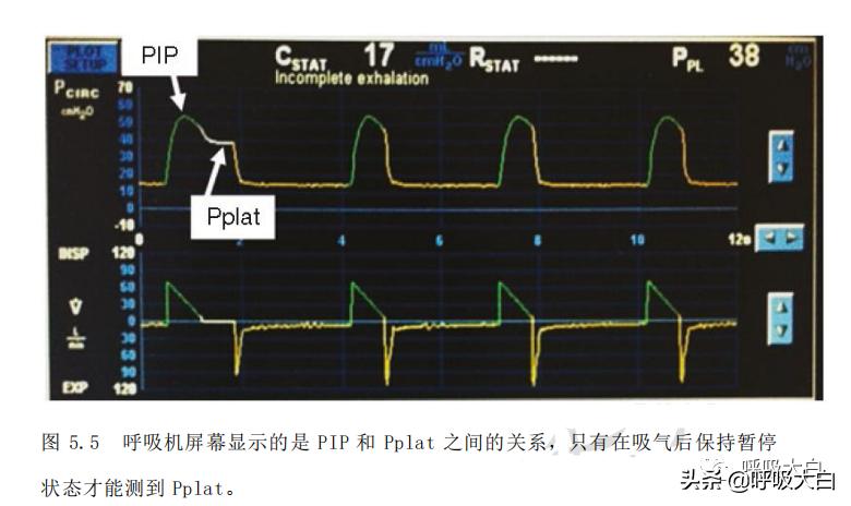 机械通气都是正压通气吗,无创机械通气和有创机械通气区别