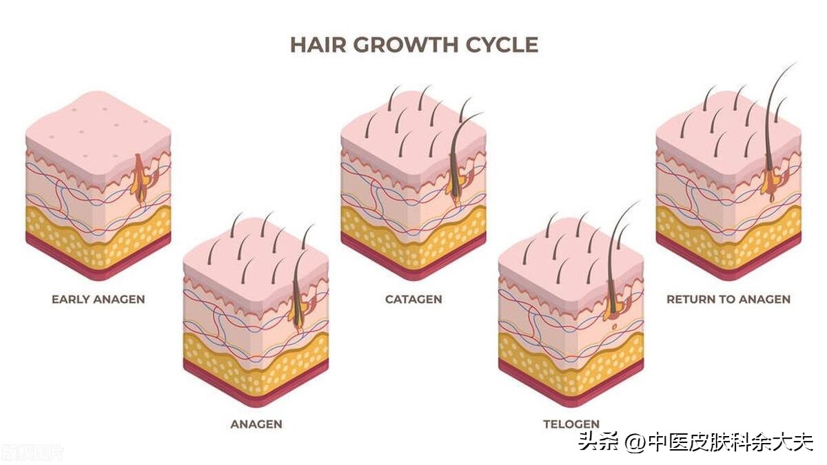 脱发是世界难题,脱发严重时不妨试试以下三招