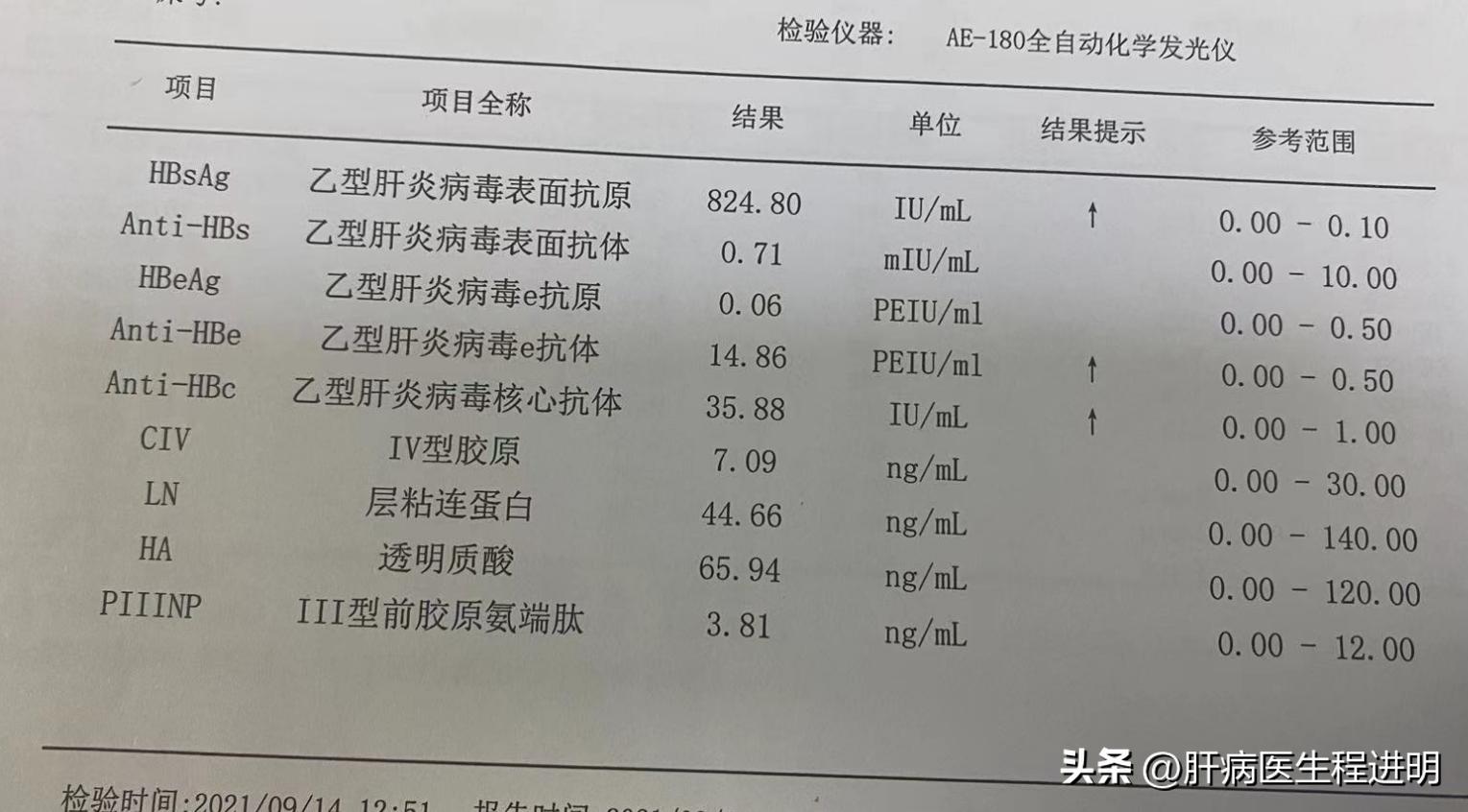 肝脏0.6厘米稍强回声结节怎么治疗,乙肝患者肝脏有结节是怎么回事