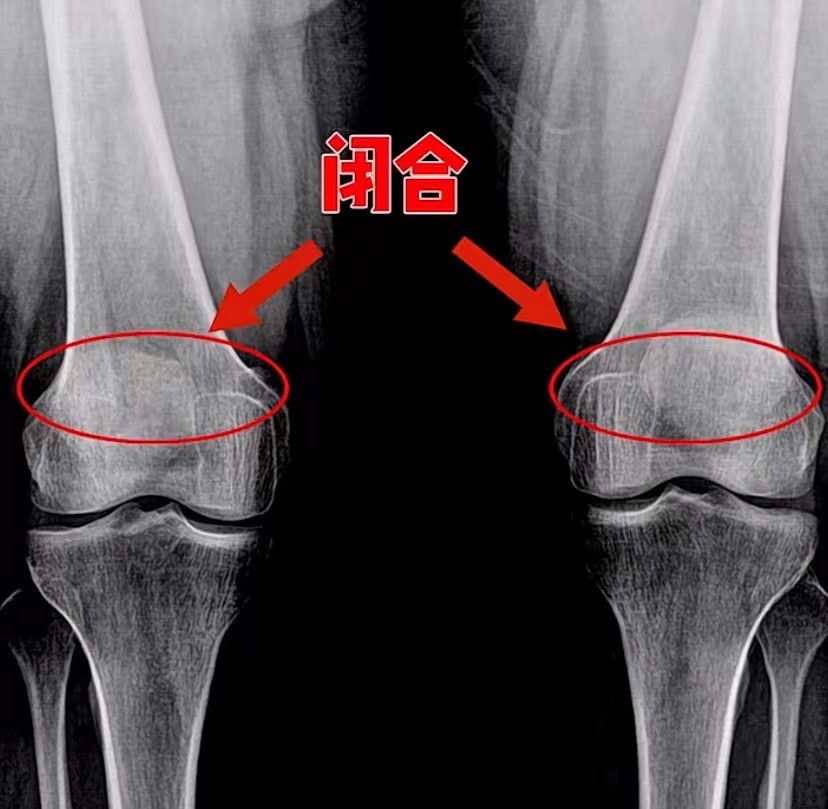 父母都不高，她却长到了170！揭秘「三段式身高管理法」