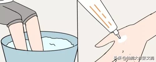 冬季手干燥裂口用什么药膏,手脚裂口一招搞定冬季必备