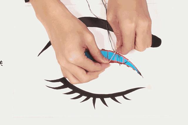 北京切开双眼皮恢复过程,北京双眼皮手术失败案例