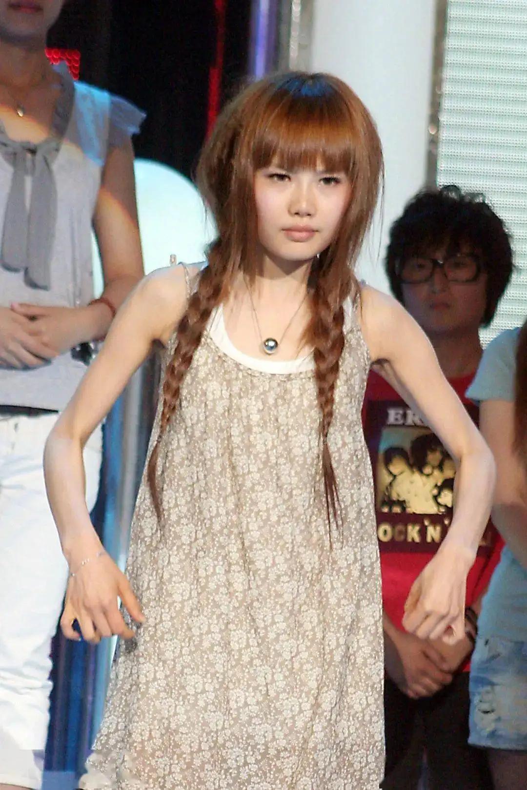 女歌手整容失败索赔100万,女歌手整容失败索赔2019