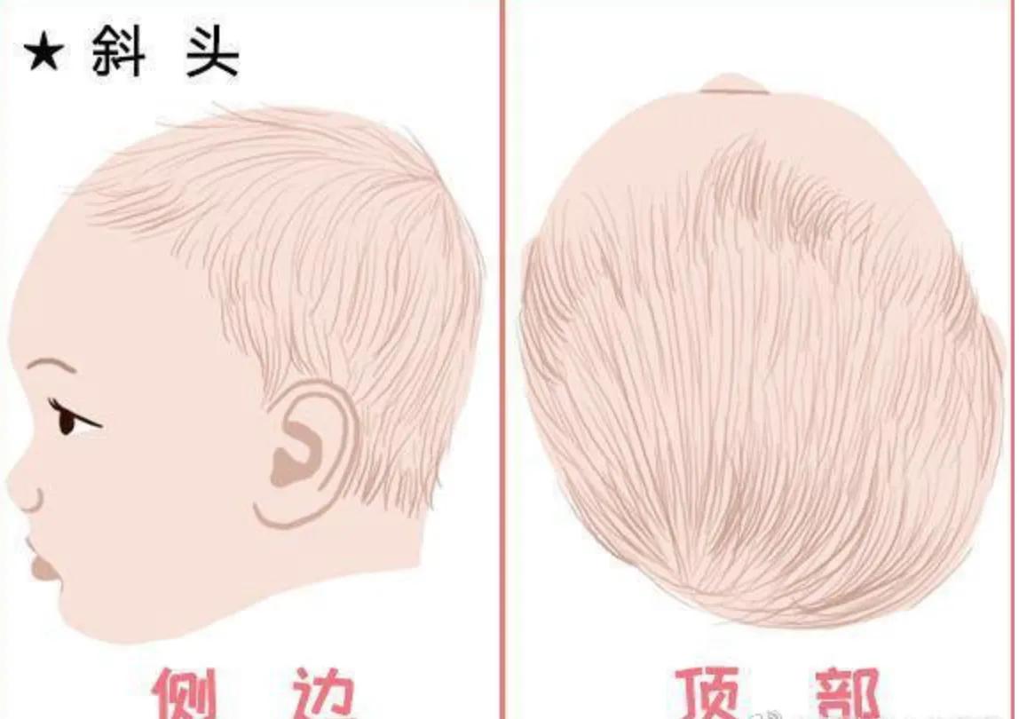 新生儿头型像冬瓜,小男孩3岁扁头发型