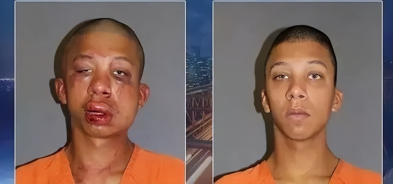 鎭嬬櫀鐥囧湪鐩戠嫳寰呴亣,鎭嬬櫀鐥囧湪鐩戠嫳琚潃