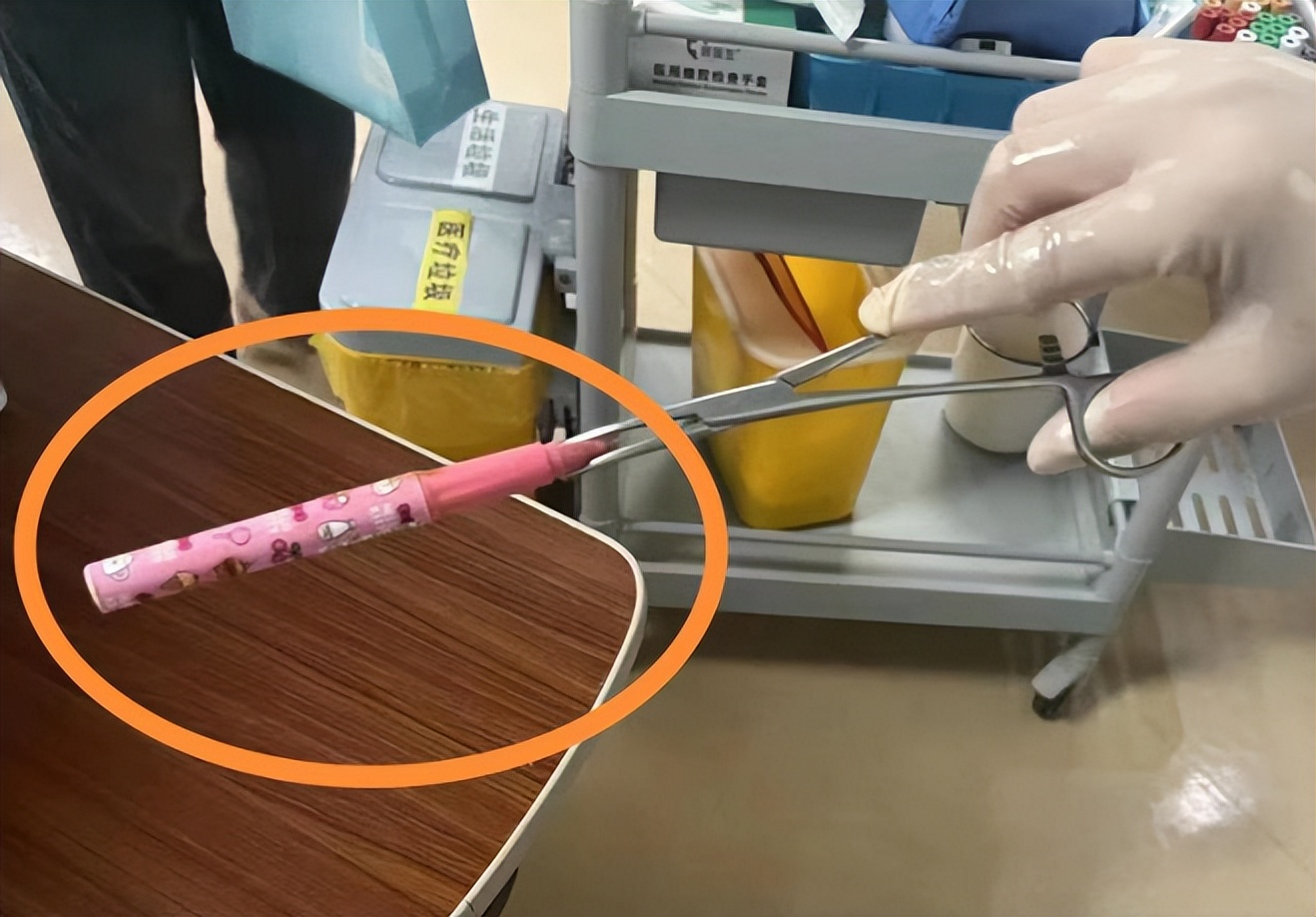 直肠内异物看病经验分享,直肠内壁异物