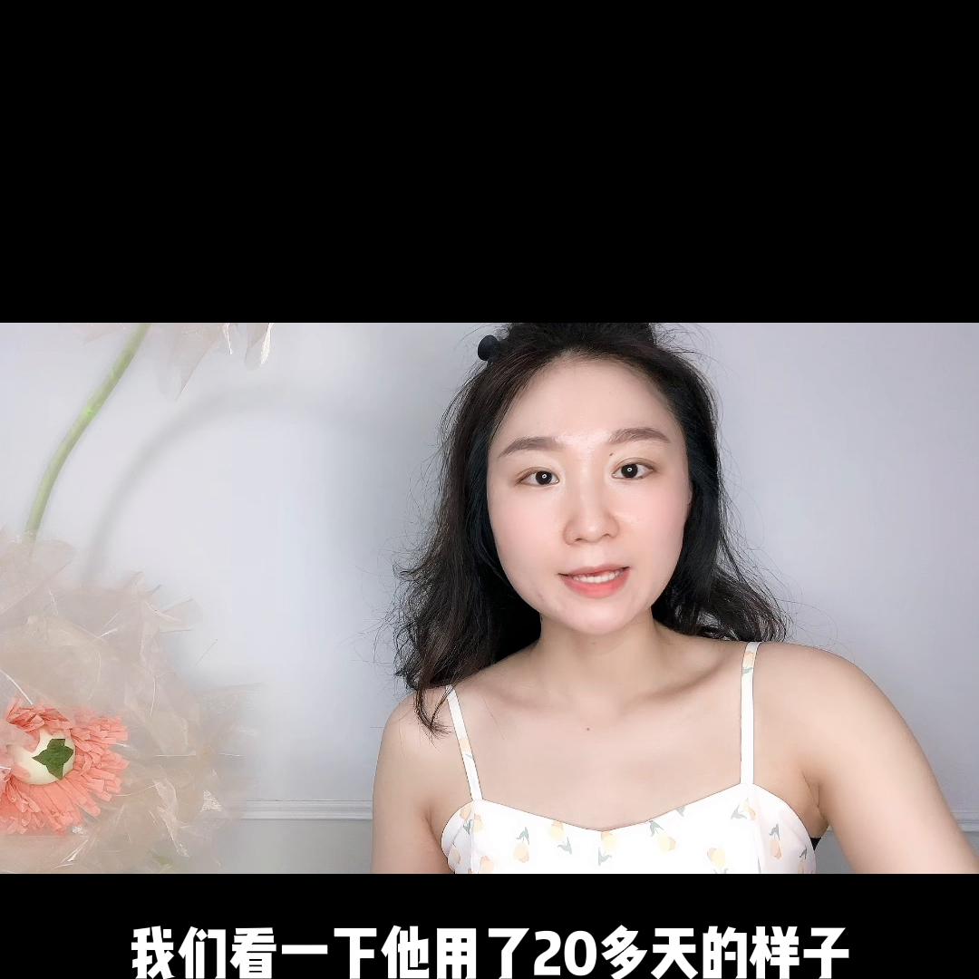 激光点痣掉痂后红印子可以护肤吗,点痣后的红印子可以正常护肤吗