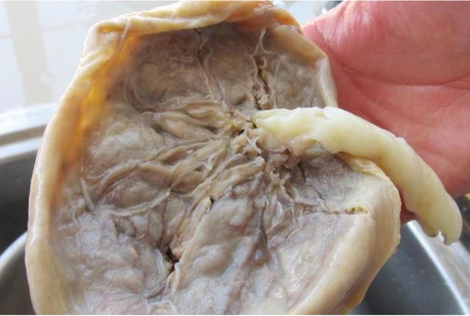 胎盘的提供者是爸爸,胎盘是爸爸的