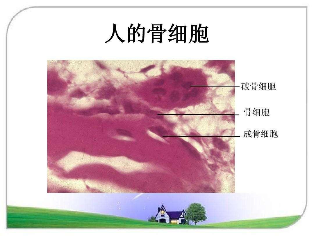 人人都离不开骨骼变老！衰老对骨骼有何影响？医生教你4招应对