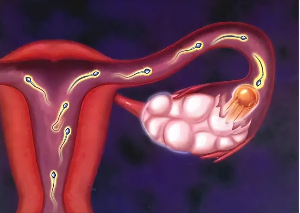 女人输卵管堵塞能治好吗,女人输卵管堵塞是什么原因