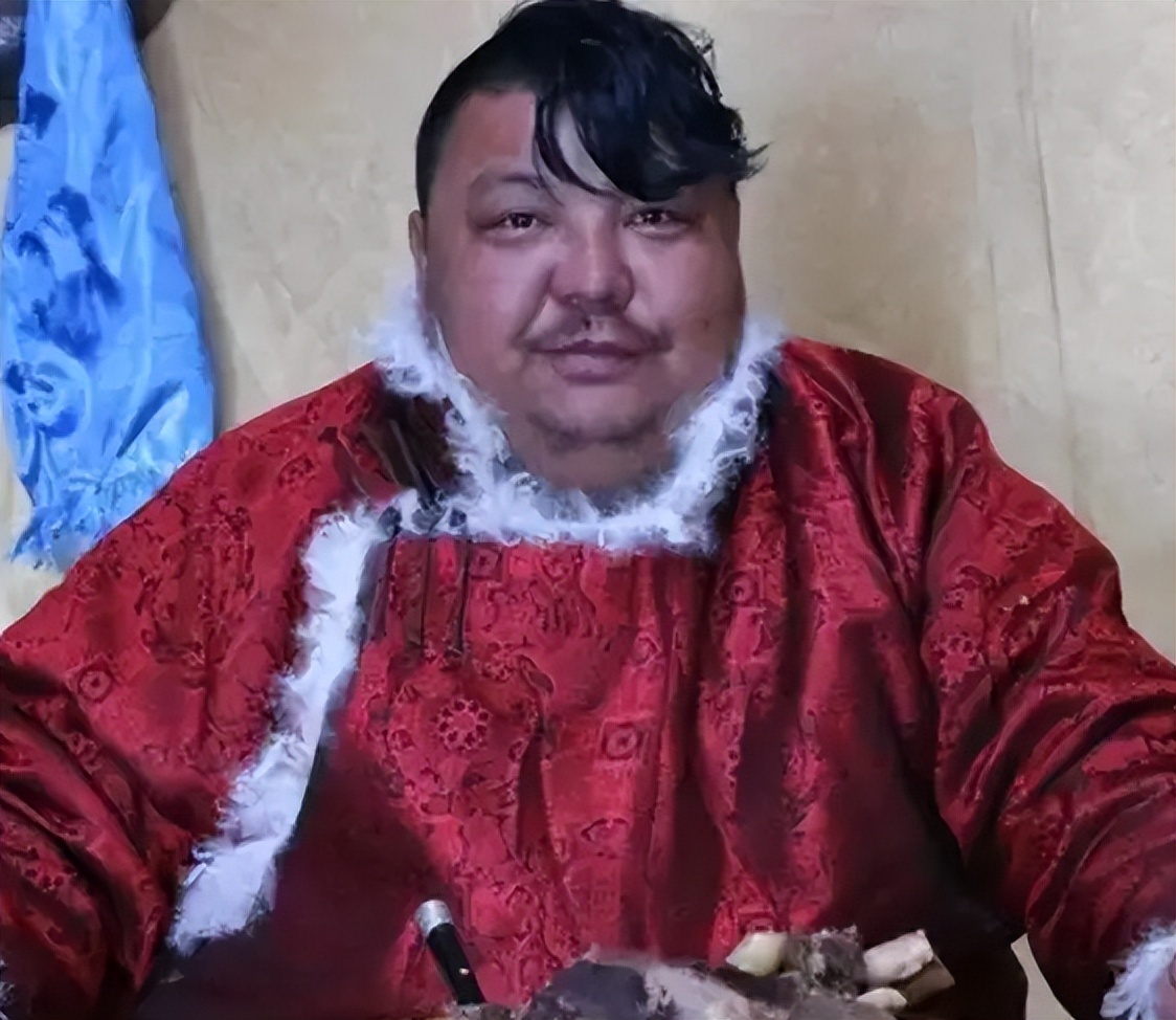 吃播界的“牛亡爷”！恩克面部黑斑扩散，网友：上厕所都成问题