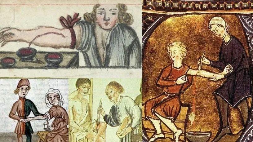 中世纪黑暗医疗脑洞大开，放血只是常规，哪里是看病分明是玩命！