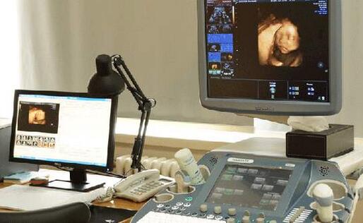 四维彩超单独收费吗,四维彩超新农合可以报销吗