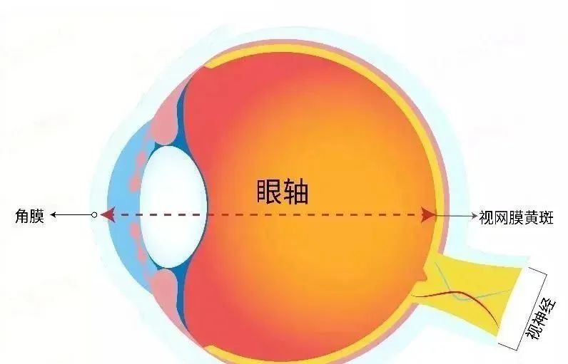 眼轴需要经常检测吗,眼轴测量有可能误测吗