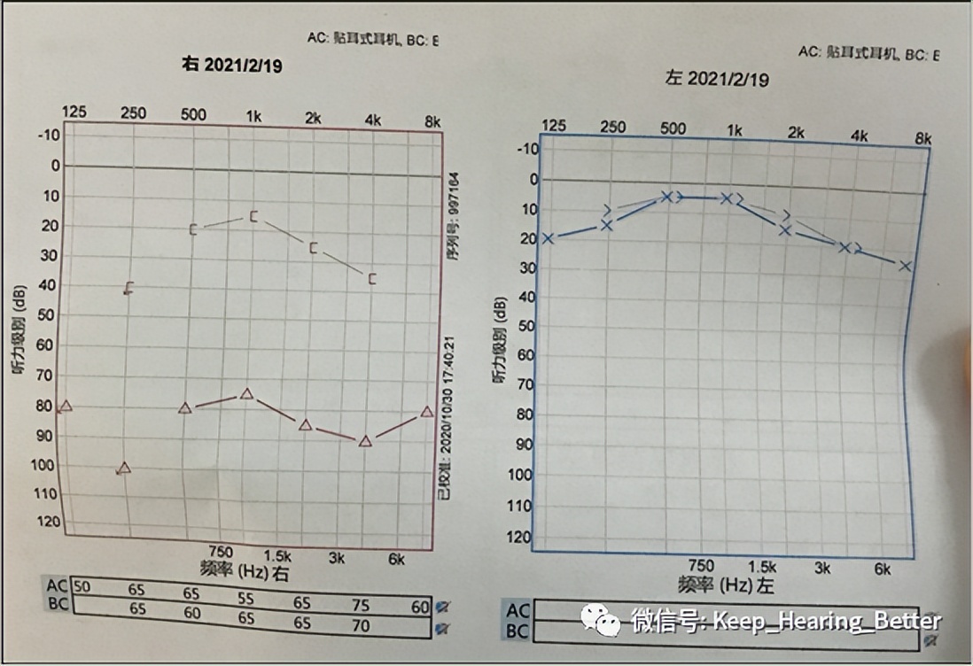 南昌大学第一附属医院鼓膜修复,南昌大学二附院耳鼻喉科专家介绍