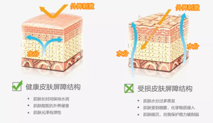 脸上起皮了是怎么回事,脸上起皮是什么原因怎么办