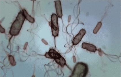 裤上污渍怎么洗,裤上有污渍怎么清洗