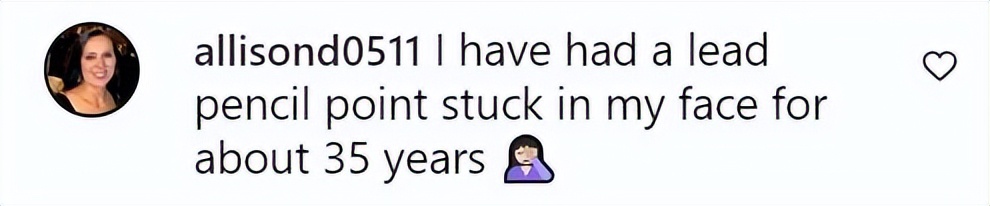 美国女子被橡皮子弹击中,女子手术取出戳20年铅笔芯