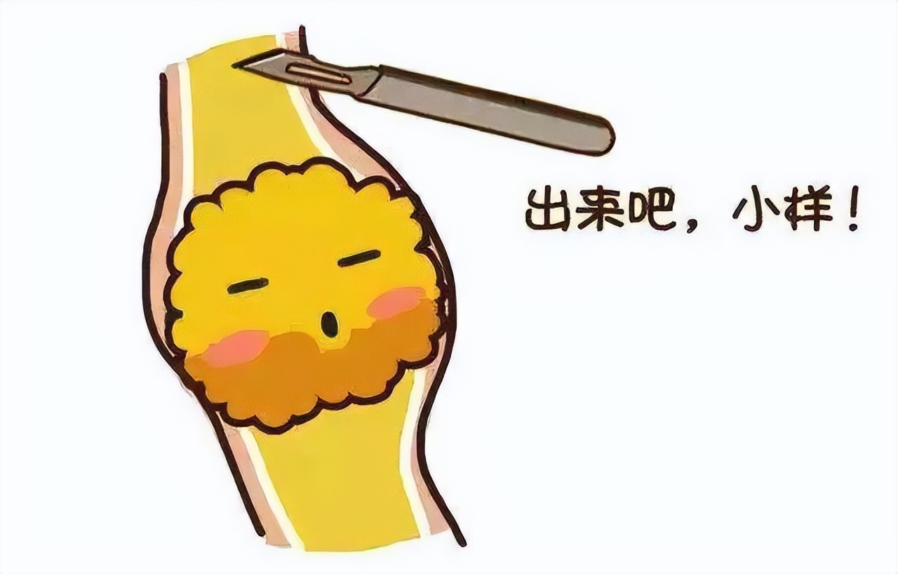 如何预防泌尿系统结石,对于泌尿系结石最有效的预防方法