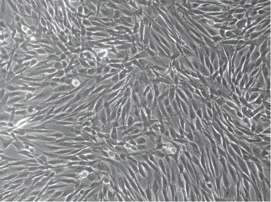 牙龈纤维瘤是肿瘤吗,牙龈纤维瘤会遗传给下一代吗