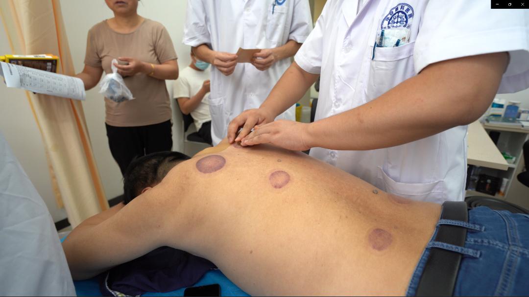 2023入伏三伏贴,三伏贴末伏最后一贴