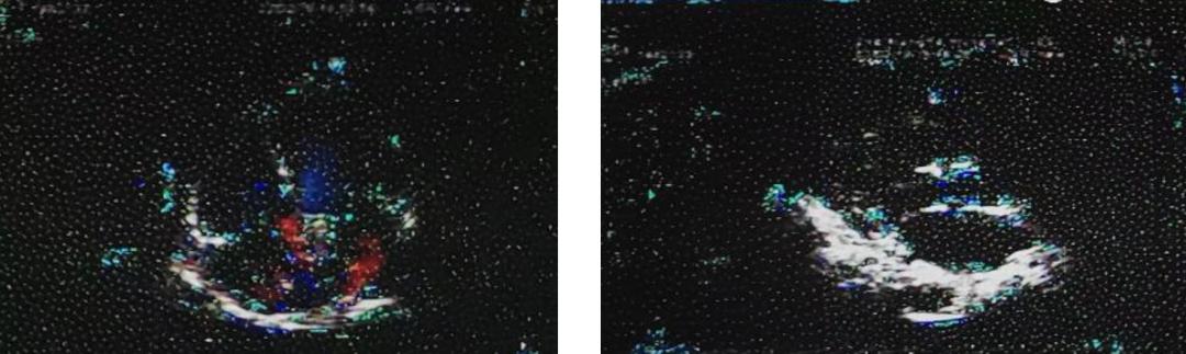 几十年间歇性胸闷气短去哪治疗,胸闷气短三年了怎么回事