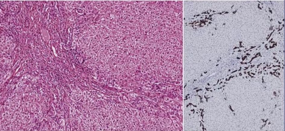肝囊肿和肝占位影像学鉴别,杨永峰医生个人简历