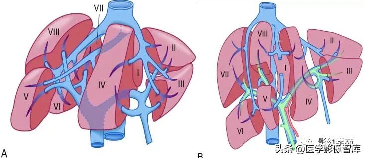 肝脏影像分叶分段解剖图,肝脏分段解剖图谱