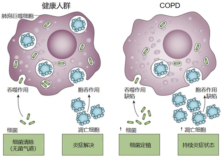 宋元林教授：「脆弱人群」即便打过疫苗，病毒仍能突破免疫屏障