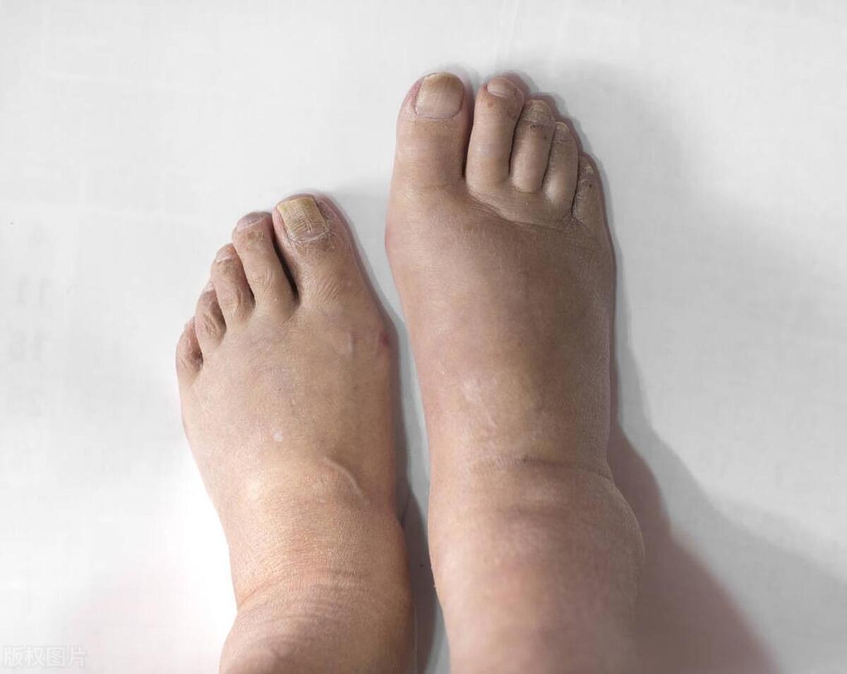 张仲景金匮要略肾气丸的治疗效果,倪海厦讲金匮肾气丸治疗功效