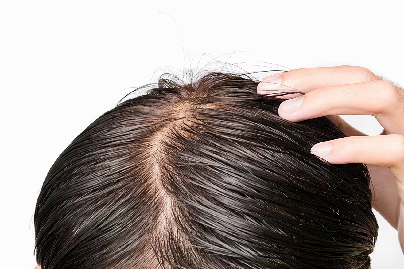 头发头顶扁塌适合什么发型,告别土气扁塌马尾