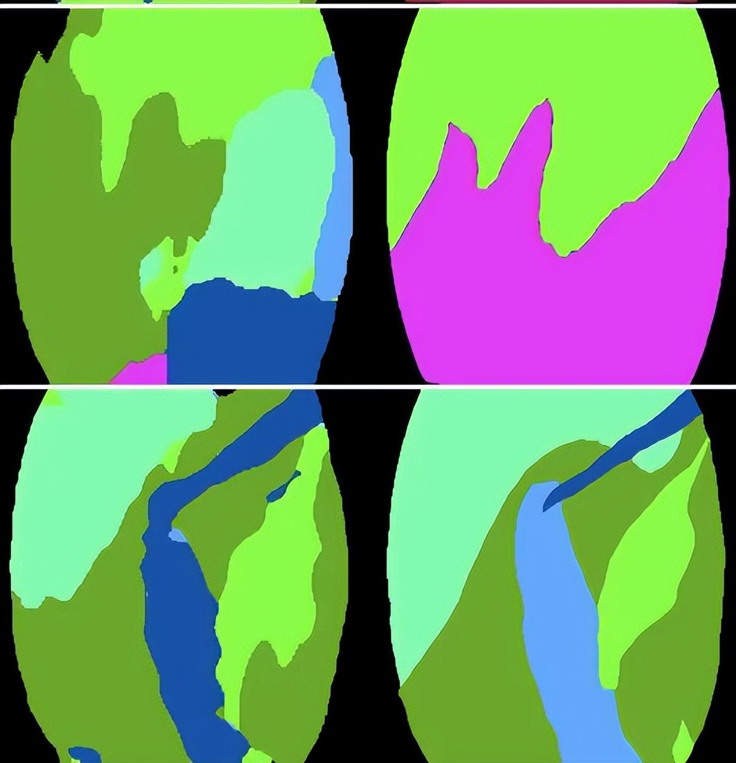 医学影像目标检测框架,开源数据集目标检测