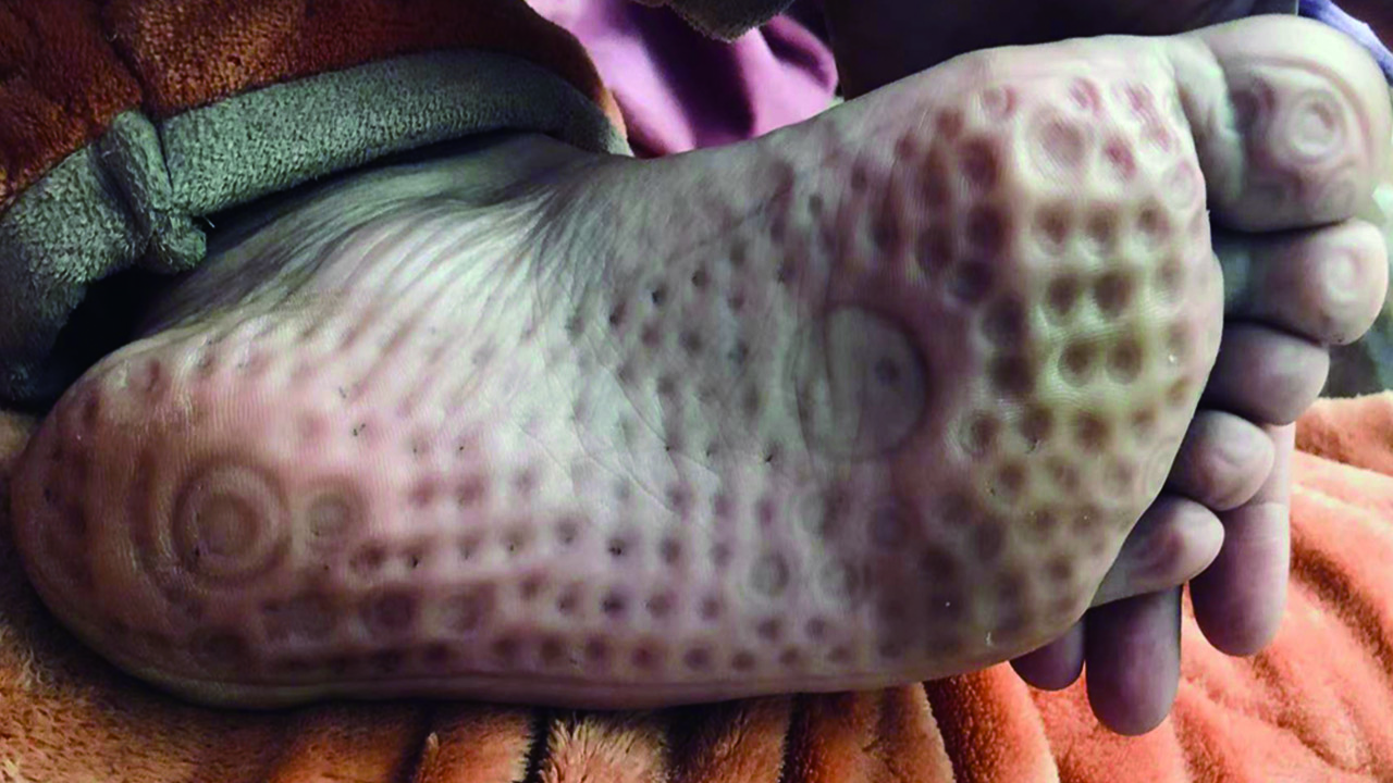 按摩鞋是不是智商税,足疗鞋是交智商税吗