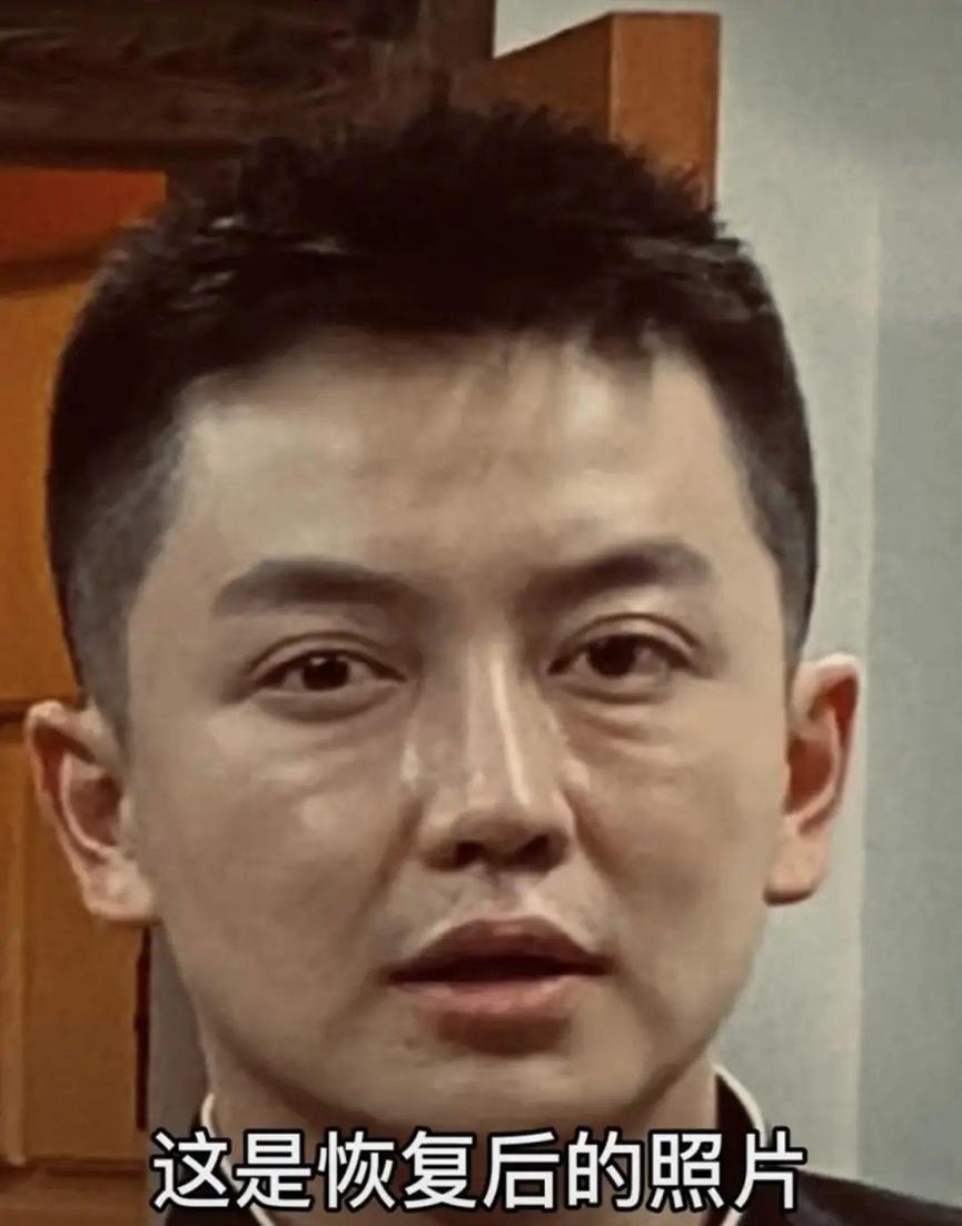 为了巴掌脸，把骨头削去一半，你害怕吗？