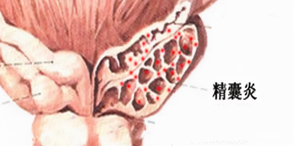 精子有些固体化是怎么回事,精子固体状态