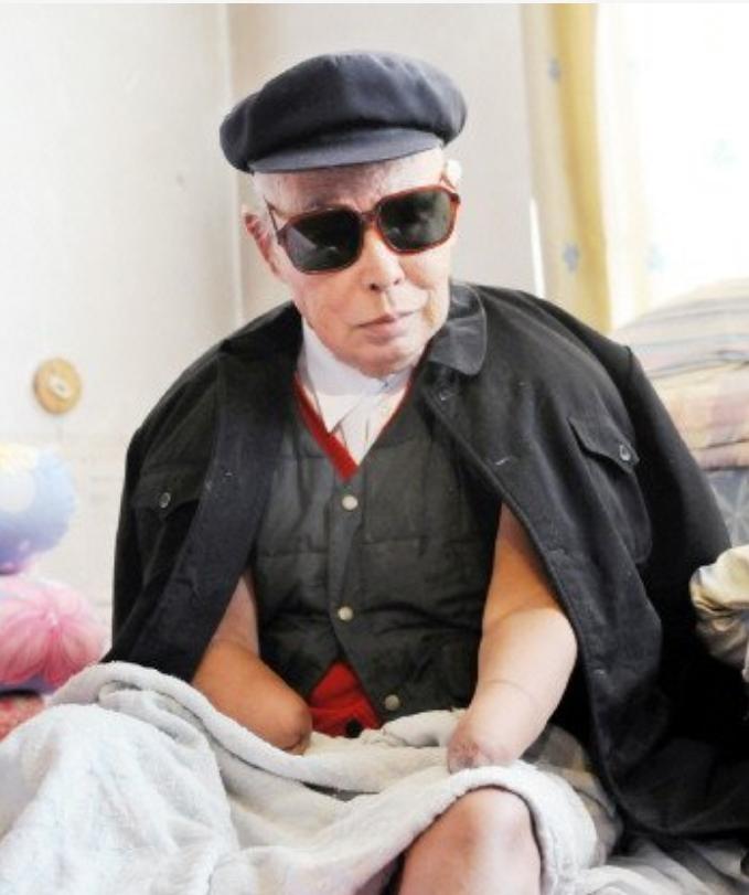 长津湖战役幸存者“朱彦夫”:失去四肢和左眼,今89岁感动中国