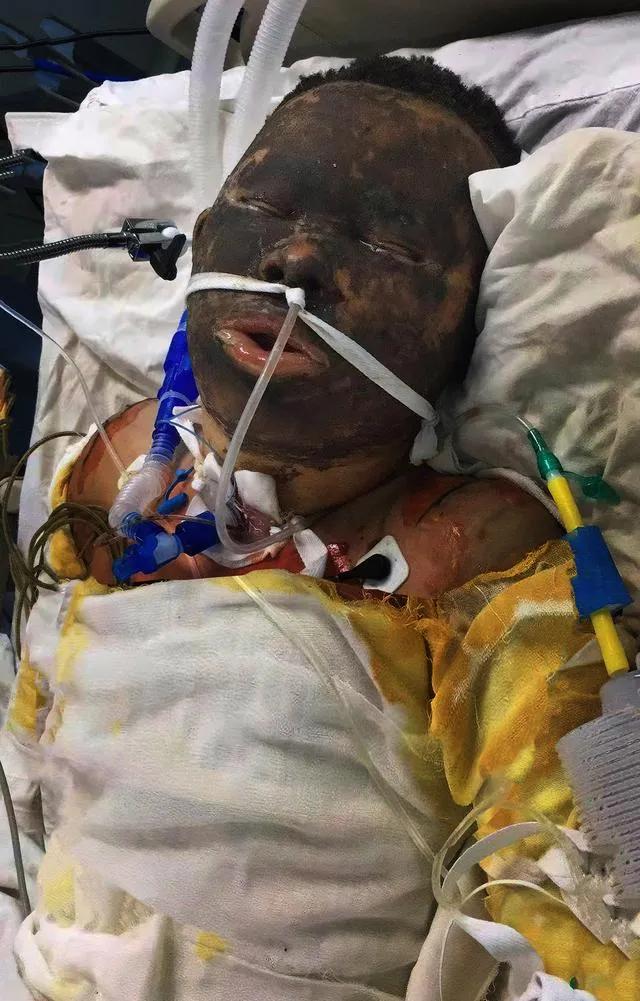 鱼竿到底会不会触碰高压电,鱼竿是绝缘为什么还会触电