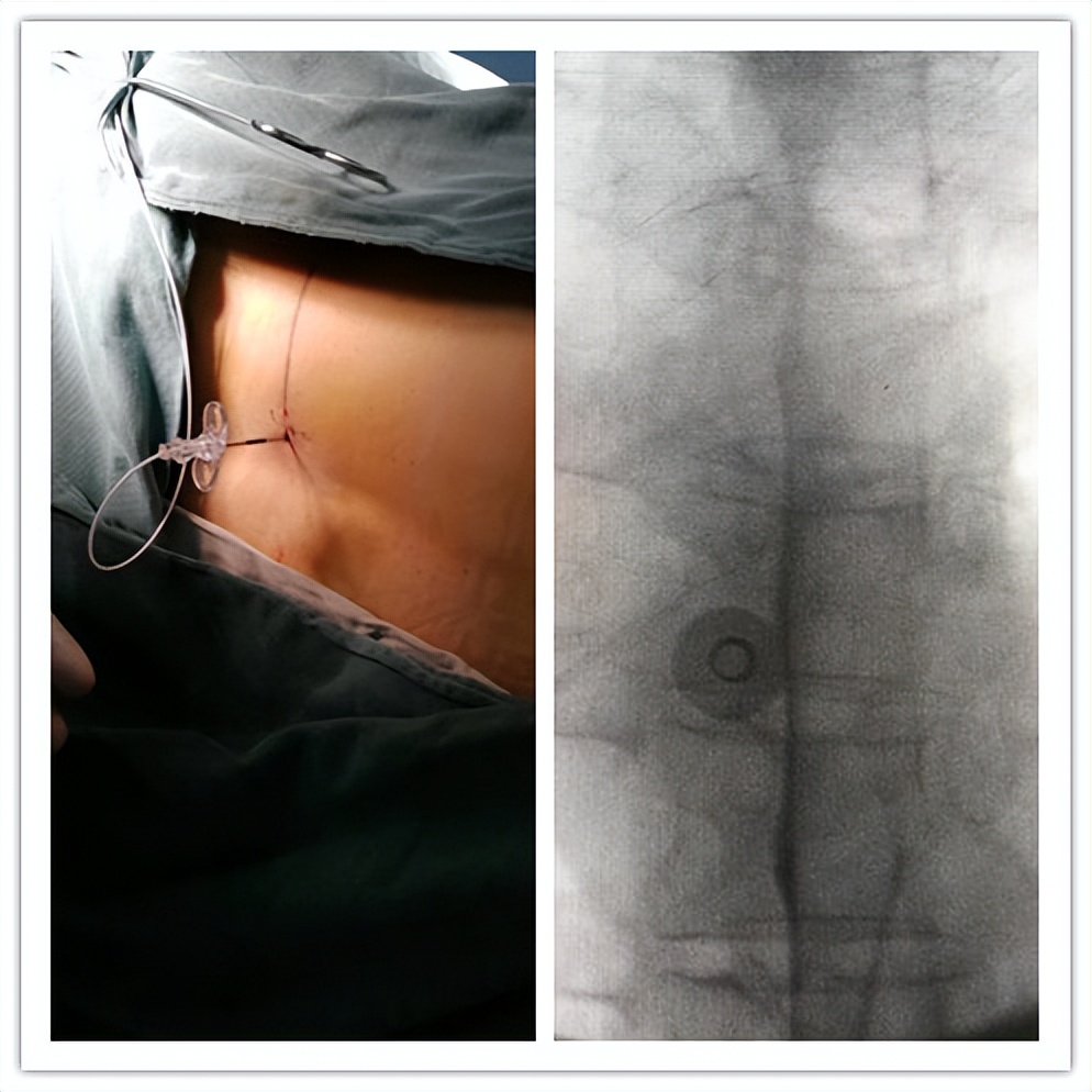 嘉善人民医院疼痛科专家,嘉善第一人民医院中医内科