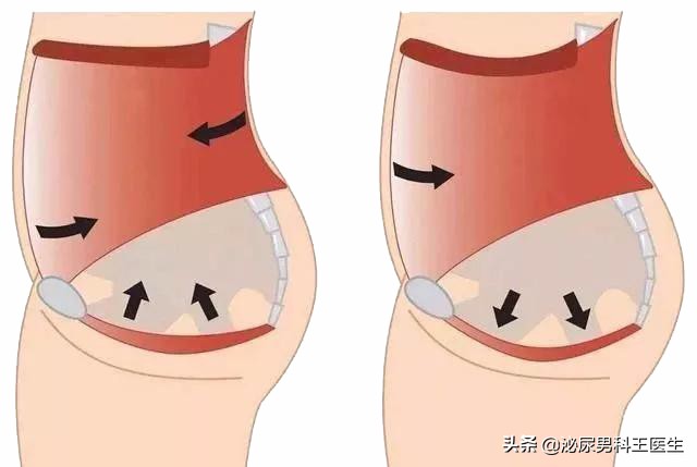 肛门瘙痒潮湿有分泌物怎么治疗,肛门潮湿还痒是什么症状