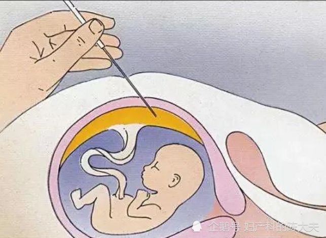 华大基因可以检测基因缺陷吗,华大基因检测报道